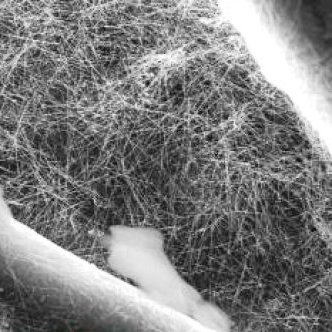 Filtro de agua de alta velocidad