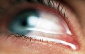 Los beneficios del adulterio